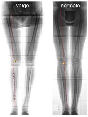 fisioterapia angolo Q
