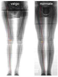 fisioterapia angolo Q