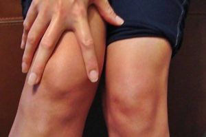 fisioterapia sindrome femororotulea